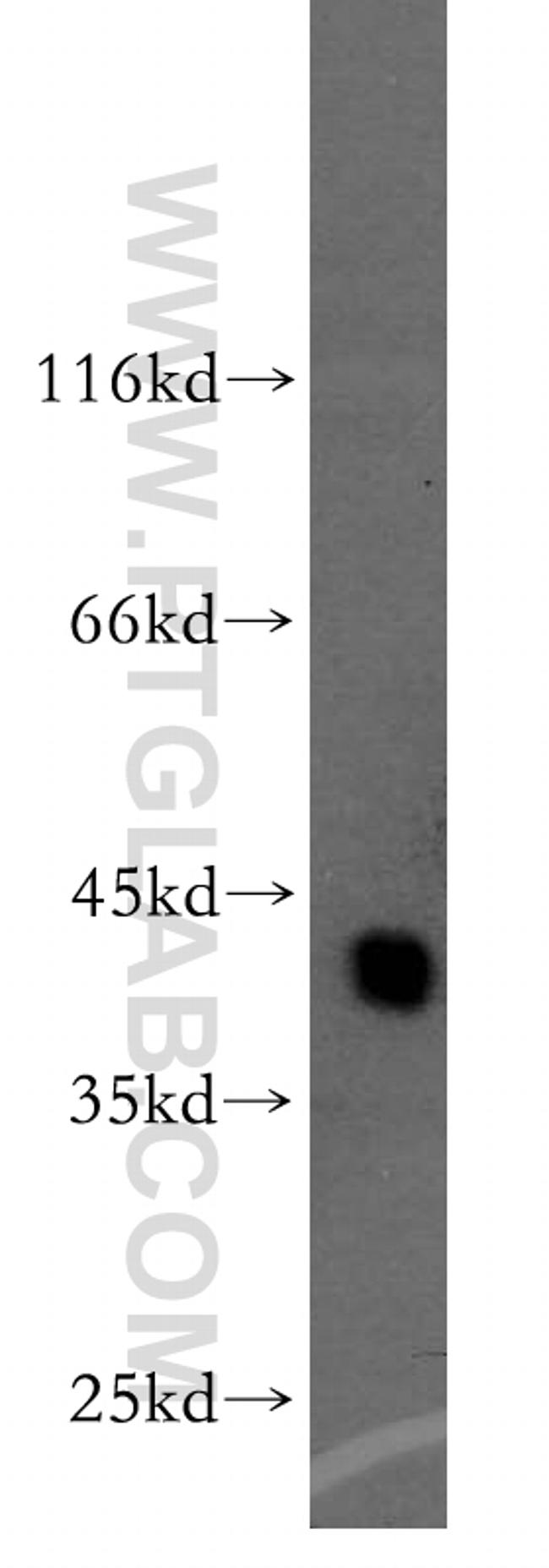 BCAT1/ECA39 Antibody in Western Blot (WB)