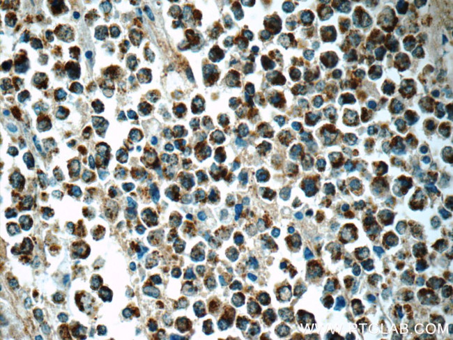 BCAT1/ECA39 Antibody in Immunohistochemistry (Paraffin) (IHC (P))