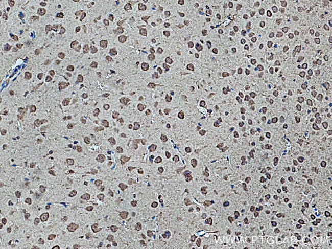 BCAT1/ECA39 Antibody in Immunohistochemistry (Paraffin) (IHC (P))