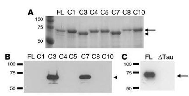 Tau Antibody in Western Blot (WB)