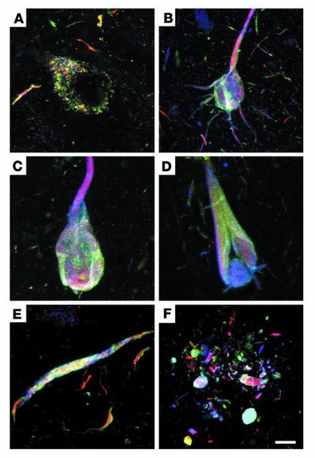 Tau Antibody in Immunohistochemistry (IHC)