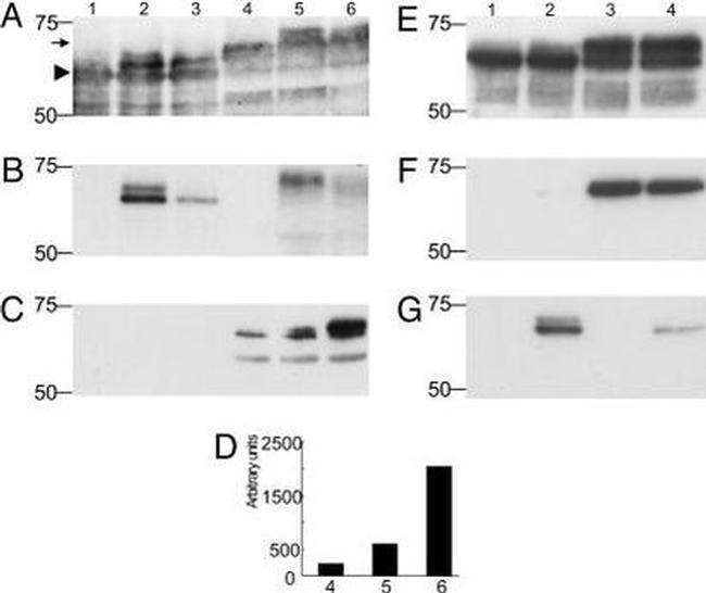 Tau Antibody in Western Blot (WB)