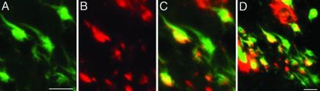 Tau Antibody in Immunocytochemistry (ICC/IF)