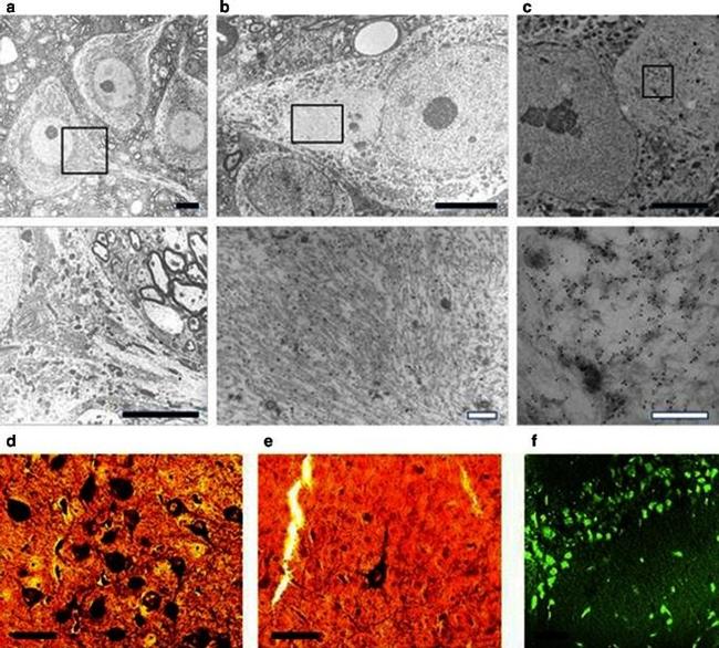 Tau Antibody in Immunohistochemistry (IHC)