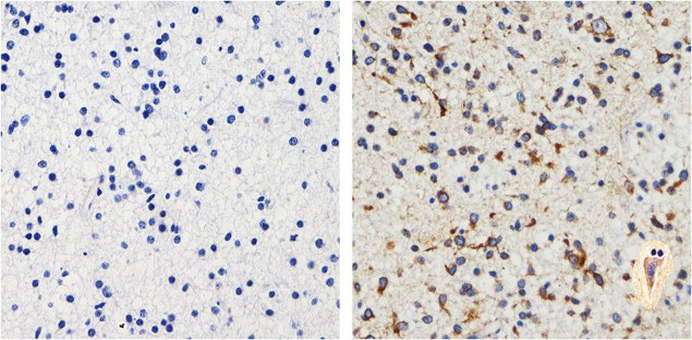 Tau Antibody in Immunohistochemistry (Paraffin) (IHC (P))