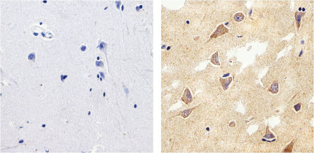 Tau Antibody in Immunohistochemistry (Paraffin) (IHC (P))