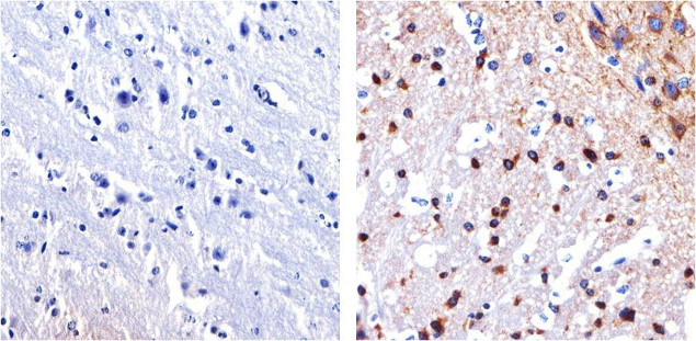 Tau Antibody in Immunohistochemistry (Paraffin) (IHC (P))