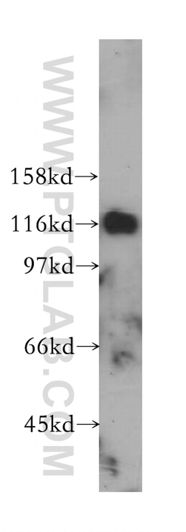 PCDH1 Antibody in Western Blot (WB)