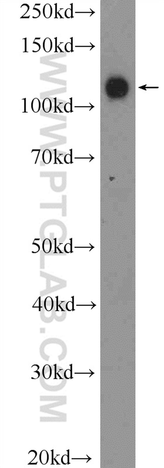 PCDH1 Antibody in Western Blot (WB)