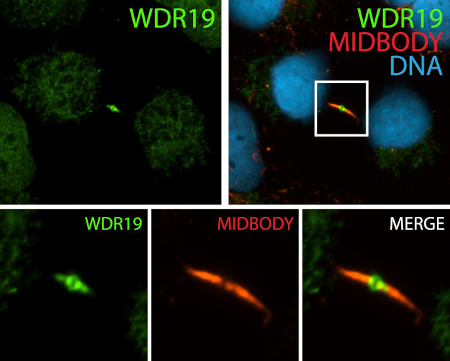 WDR19/IFT144 Antibody in Immunocytochemistry (ICC/IF)