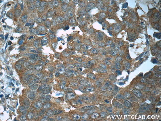 WDR19/IFT144 Antibody in Immunohistochemistry (Paraffin) (IHC (P))