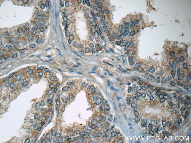 WDR19/IFT144 Antibody in Immunohistochemistry (Paraffin) (IHC (P))