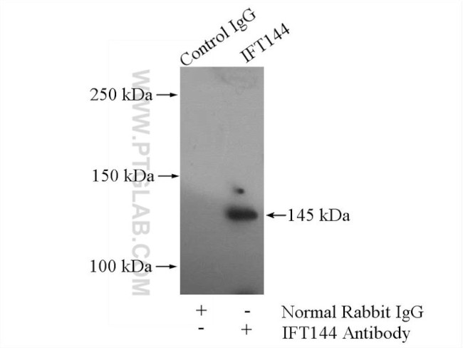 WDR19/IFT144 Antibody in Immunoprecipitation (IP)