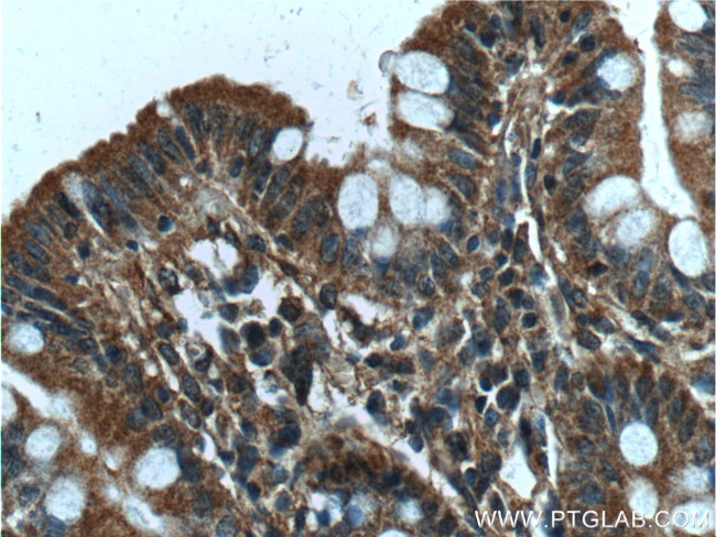 NARFL Antibody in Immunohistochemistry (Paraffin) (IHC (P))