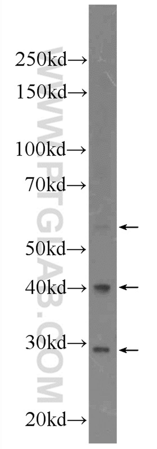 NARFL Antibody in Western Blot (WB)