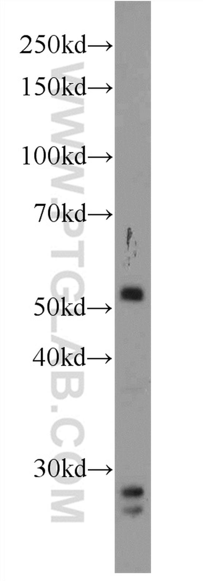 NARFL Antibody in Western Blot (WB)