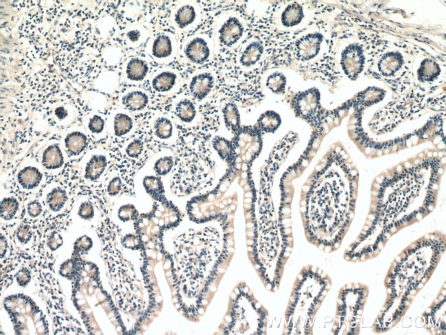 ENTPD2 Antibody in Immunohistochemistry (Paraffin) (IHC (P))