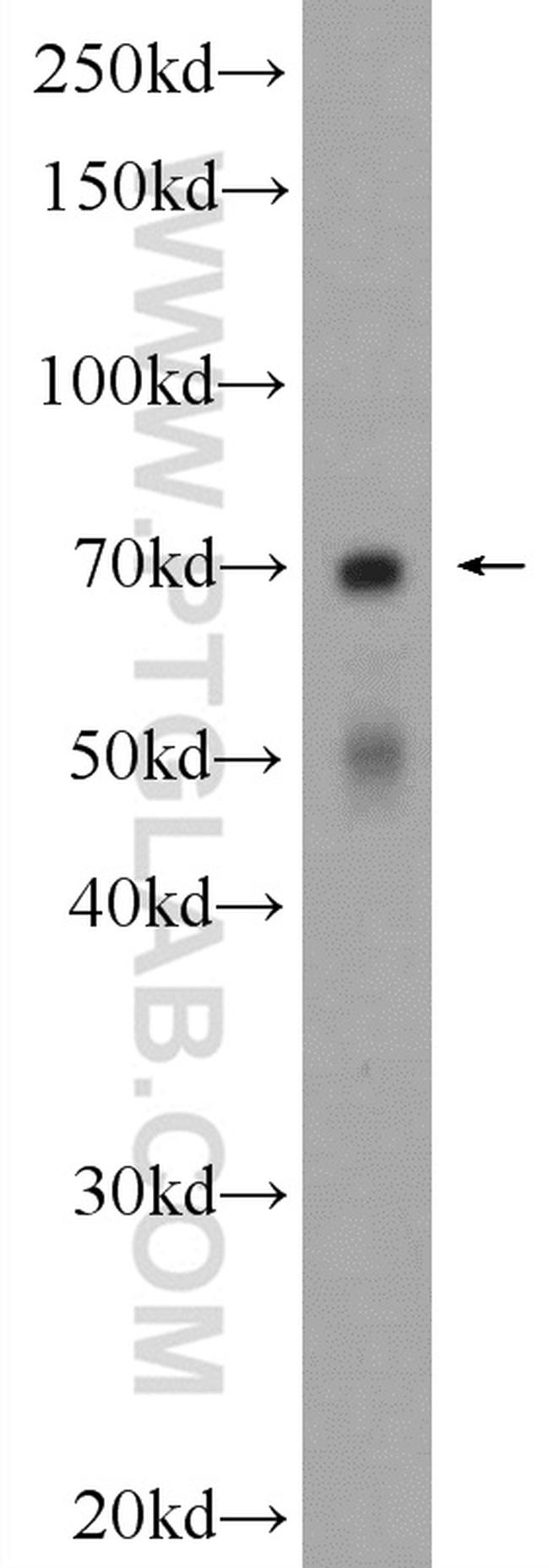 ENTPD2 Antibody in Western Blot (WB)