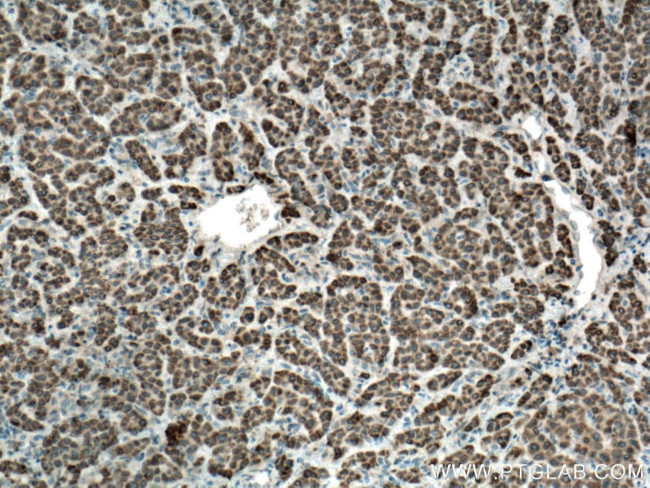 SLC35A2 Antibody in Immunohistochemistry (Paraffin) (IHC (P))