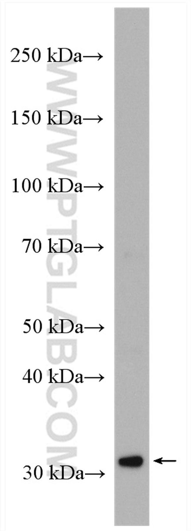 SLC35A2 Antibody in Western Blot (WB)