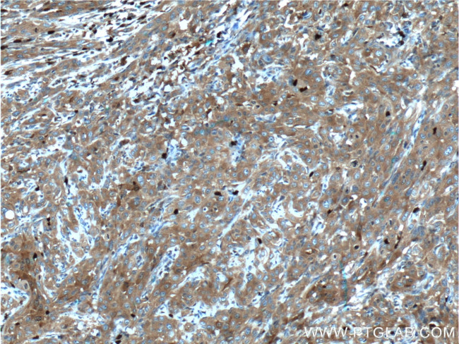 GART Antibody in Immunohistochemistry (Paraffin) (IHC (P))