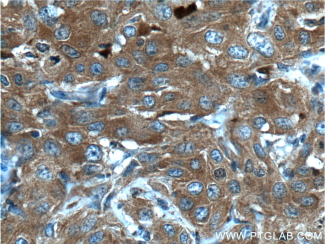 GART Antibody in Immunohistochemistry (Paraffin) (IHC (P))