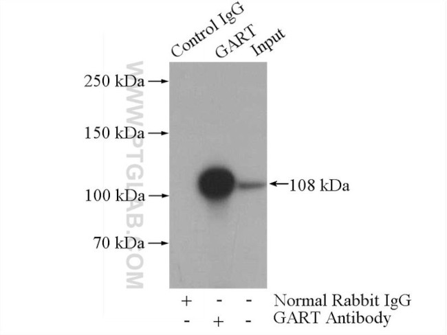 GART Antibody in Immunoprecipitation (IP)