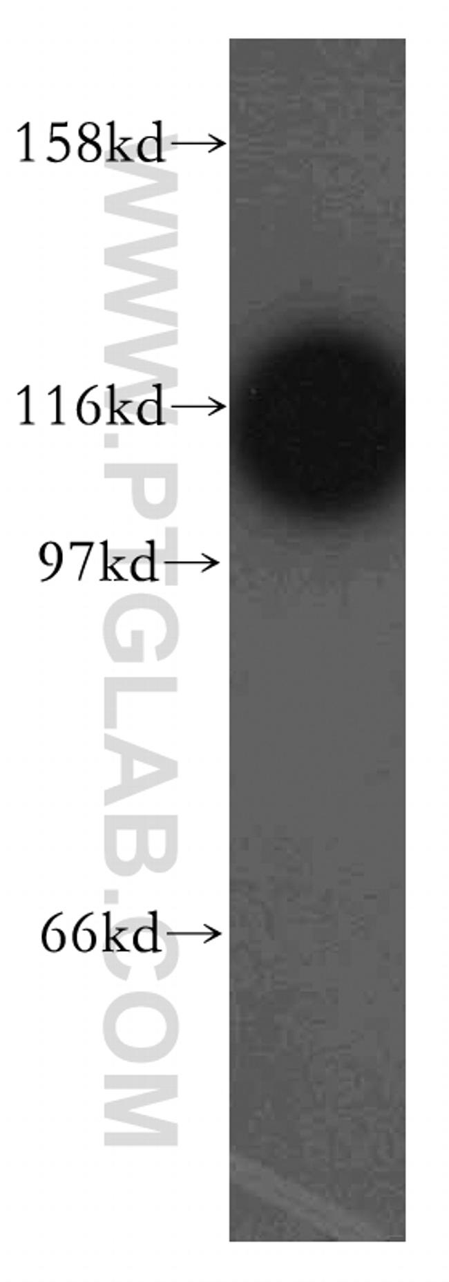 GART Antibody in Western Blot (WB)