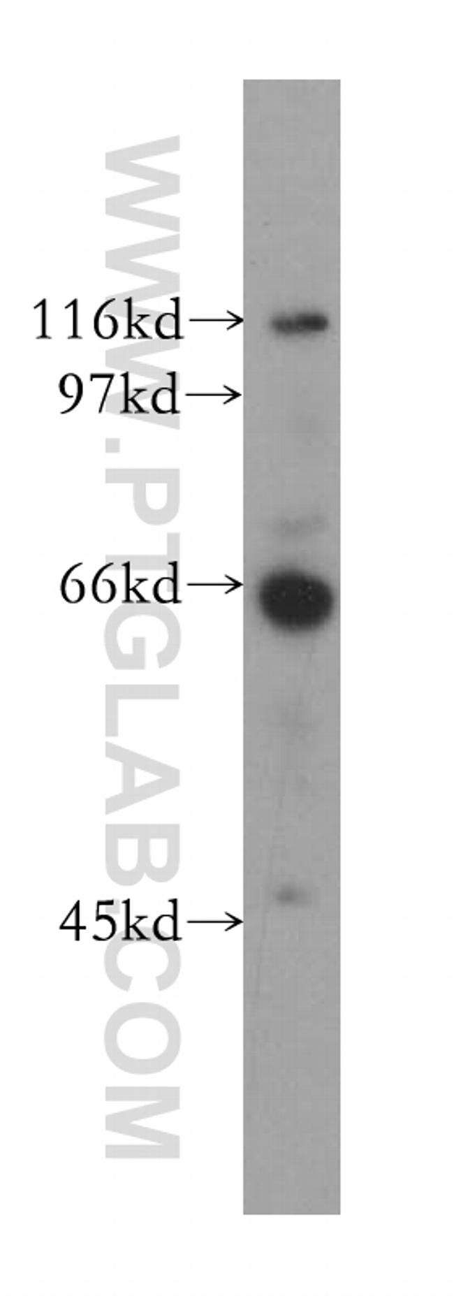 CDC14A Antibody in Western Blot (WB)