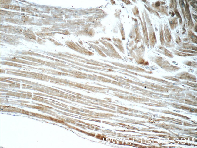 CRMP4 Antibody in Immunohistochemistry (Paraffin) (IHC (P))