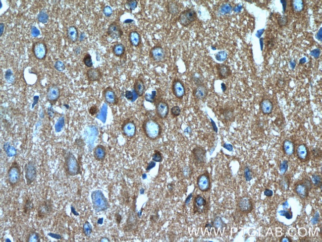 CRMP4 Antibody in Immunohistochemistry (Paraffin) (IHC (P))