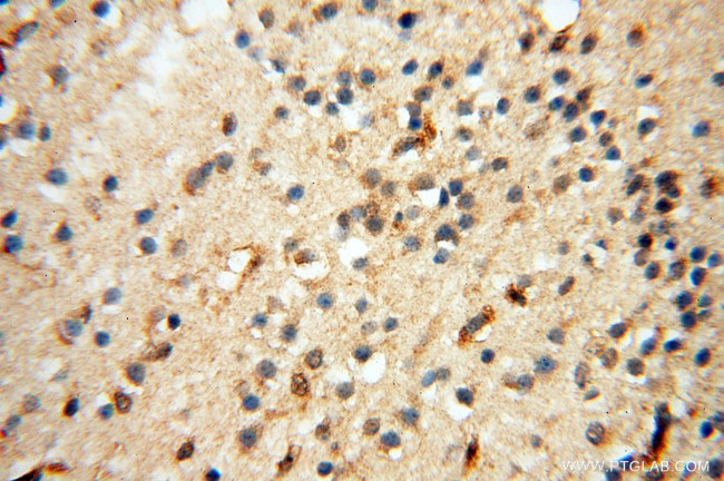 LTA4H Antibody in Immunohistochemistry (Paraffin) (IHC (P))