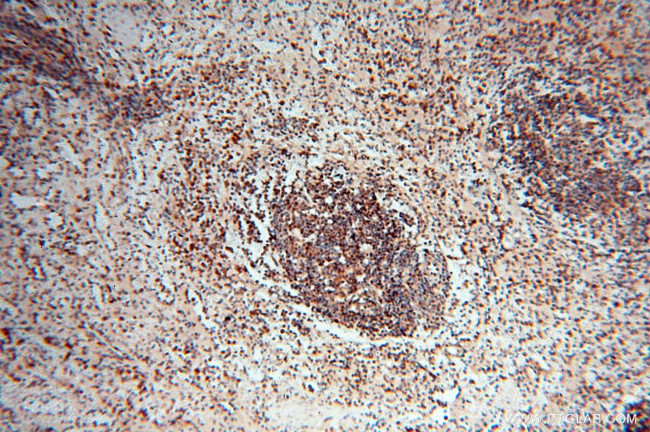 LTA4H Antibody in Immunohistochemistry (Paraffin) (IHC (P))