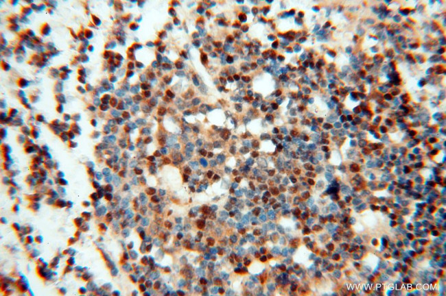 LTA4H Antibody in Immunohistochemistry (Paraffin) (IHC (P))