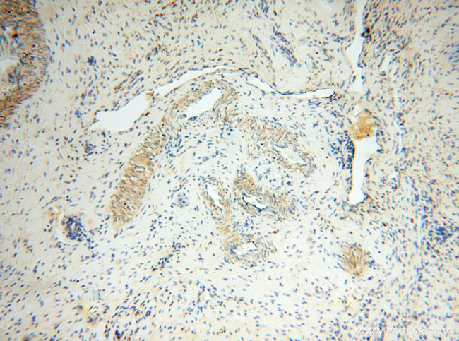 LTA4H Antibody in Immunohistochemistry (Paraffin) (IHC (P))