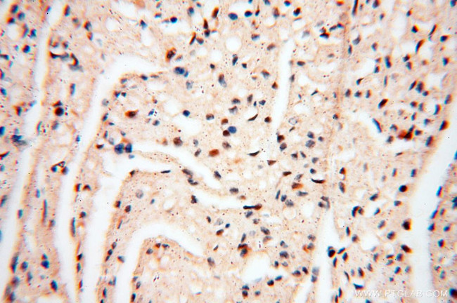 LTA4H Antibody in Immunohistochemistry (Paraffin) (IHC (P))