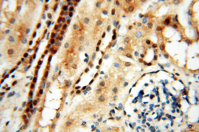 LTA4H Antibody in Immunohistochemistry (Paraffin) (IHC (P))