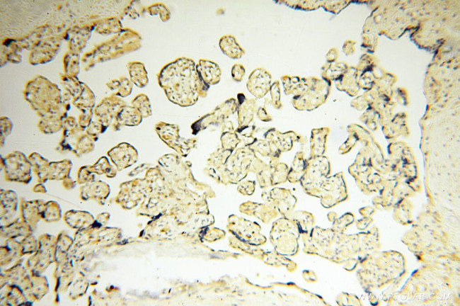 LTA4H Antibody in Immunohistochemistry (Paraffin) (IHC (P))