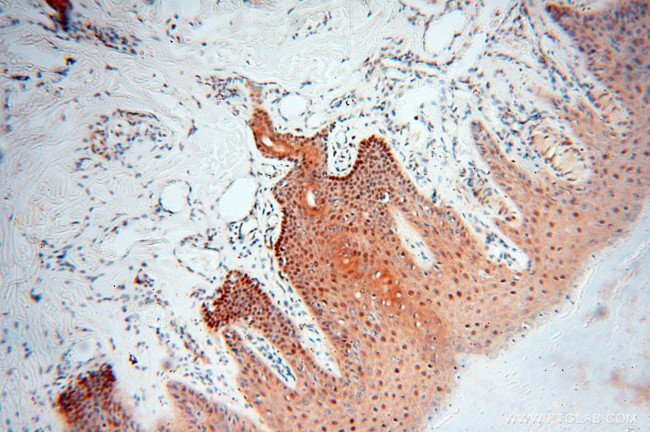 LTA4H Antibody in Immunohistochemistry (Paraffin) (IHC (P))