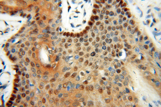 LTA4H Antibody in Immunohistochemistry (Paraffin) (IHC (P))