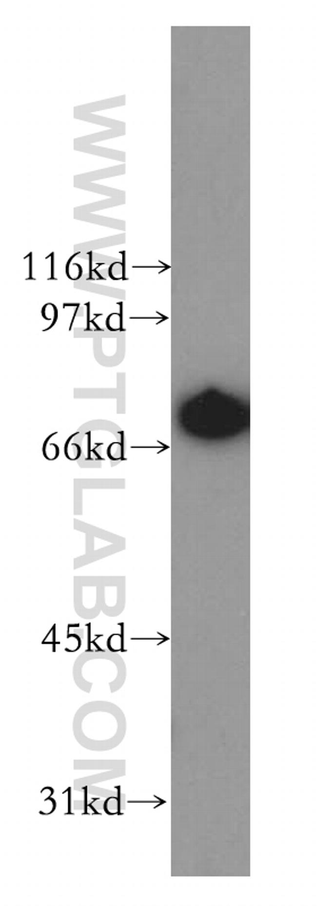 LTA4H Antibody in Western Blot (WB)