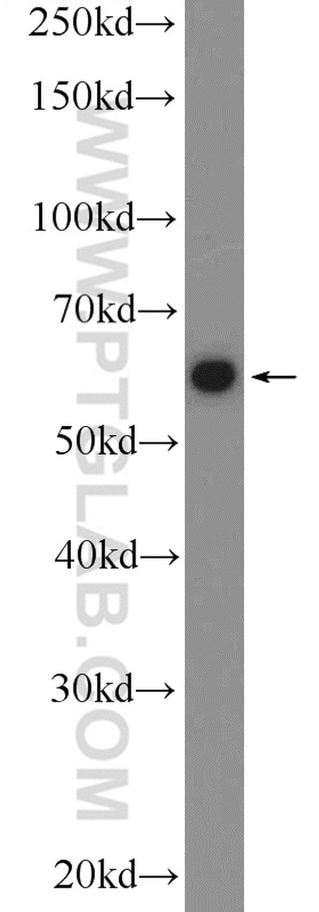 LTA4H Antibody in Western Blot (WB)