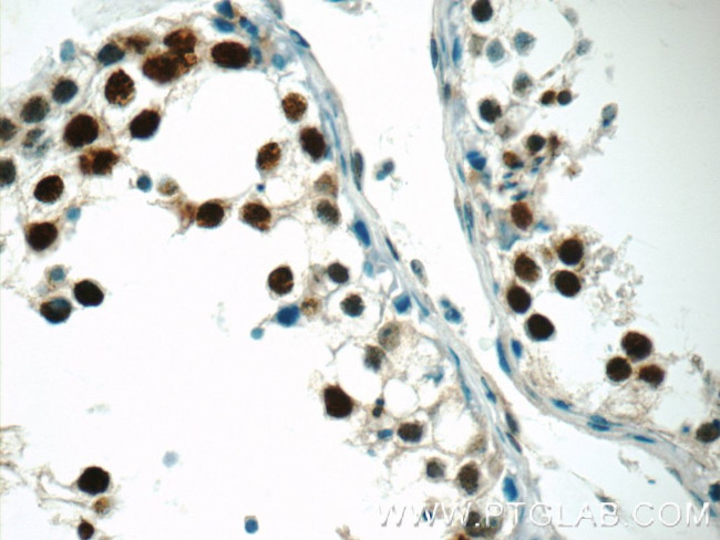 CTNNBL1 Antibody in Immunohistochemistry (Paraffin) (IHC (P))