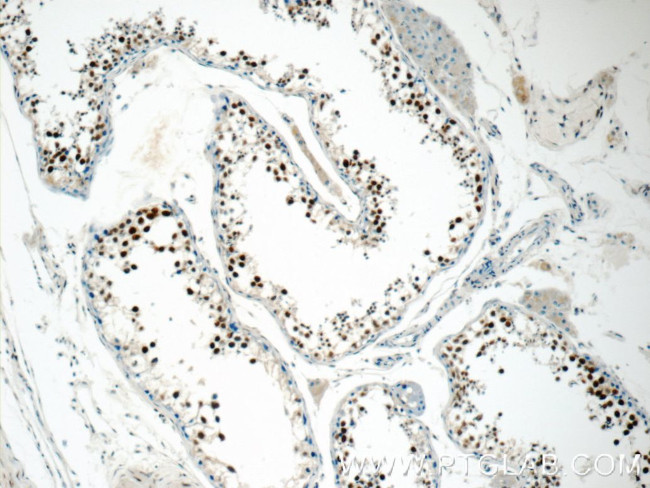 CTNNBL1 Antibody in Immunohistochemistry (Paraffin) (IHC (P))