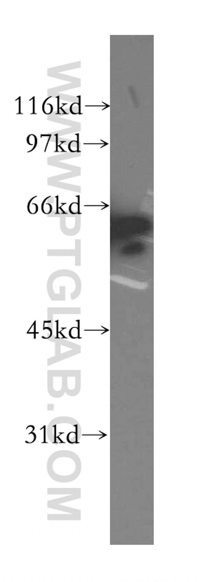 CTNNBL1 Antibody in Western Blot (WB)