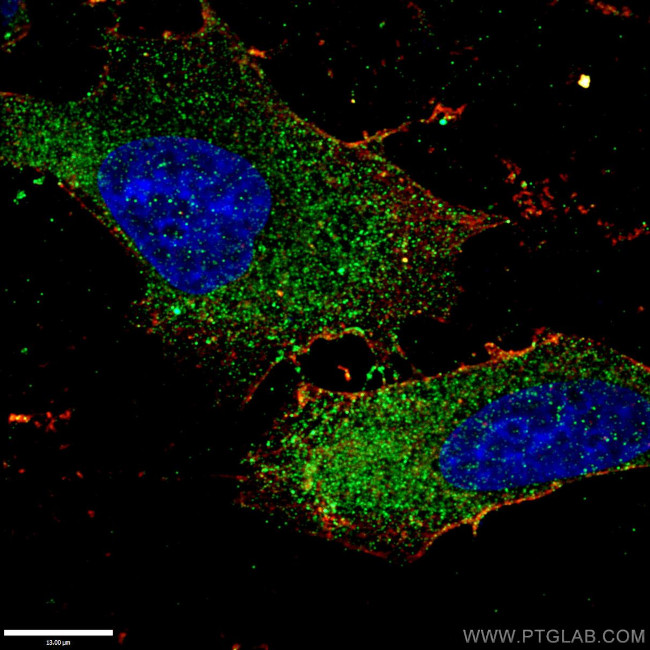 PEX1 Antibody in Immunocytochemistry (ICC/IF)