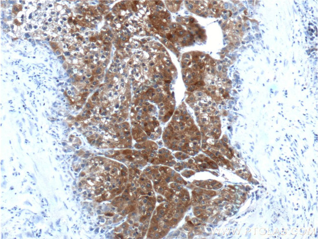 PEX1 Antibody in Immunohistochemistry (Paraffin) (IHC (P))