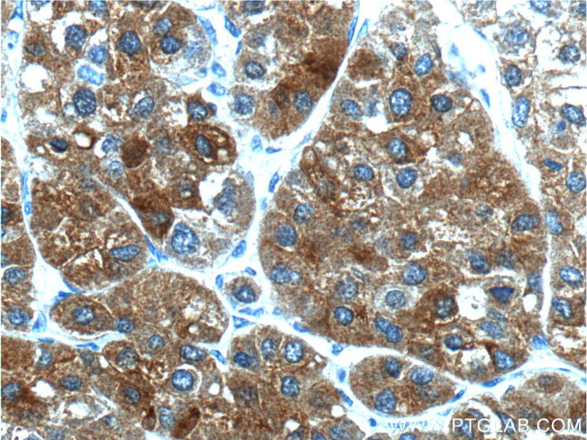 PEX1 Antibody in Immunohistochemistry (Paraffin) (IHC (P))