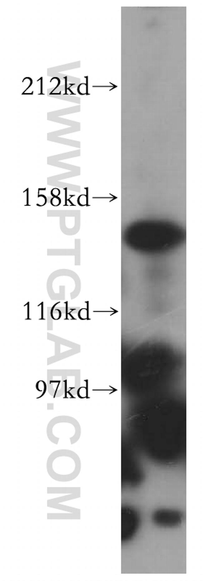 PEX1 Antibody in Western Blot (WB)