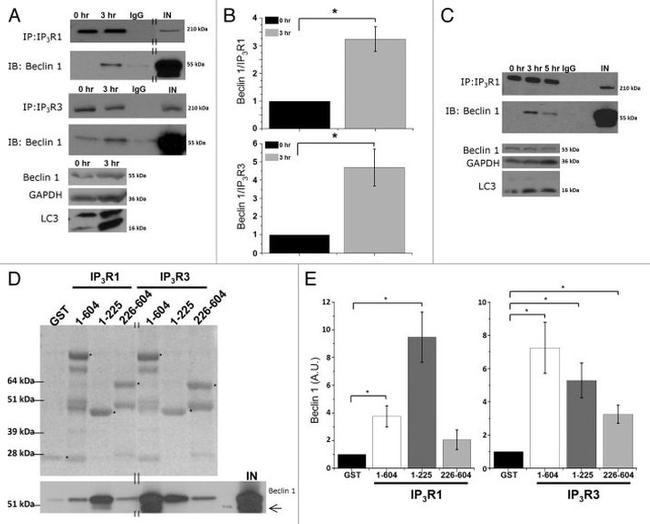 GST Tag Antibody in Western Blot (WB)